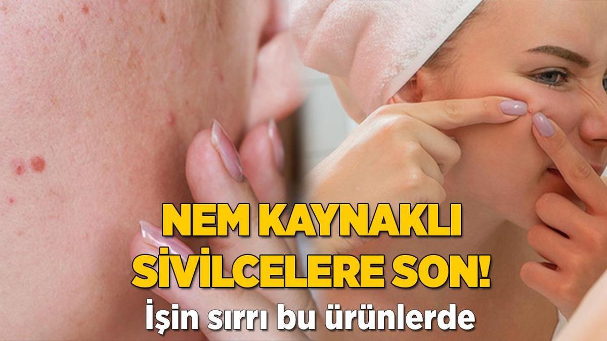 Nem oluşumu sivilceye yol açıyor! İşin sırrı bu ürünlerde saklı